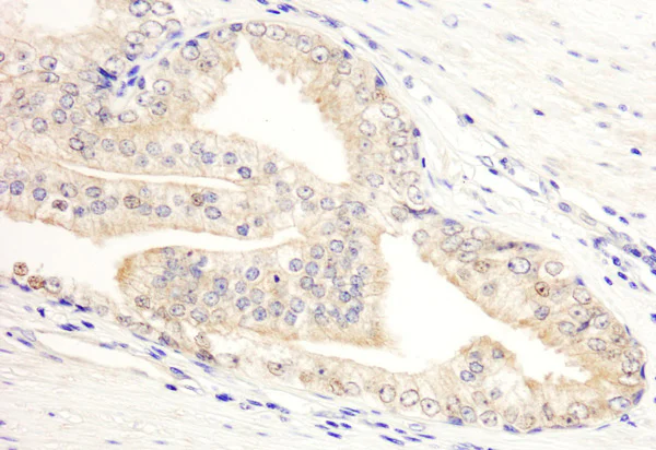 Immunohistochemistry (Formalin/PFA-fixed paraffin-embedded sections) - Anti-KANK2 antibody (AB99351)