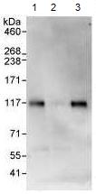 Immunoprecipitation - Anti-KANK2 antibody (AB99351), expandable thumbnail