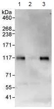 Immunoprecipitation - Anti-KANK2 antibody (AB99351)