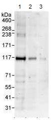 Western blot - Anti-KANK2 antibody (AB99351), expandable thumbnail