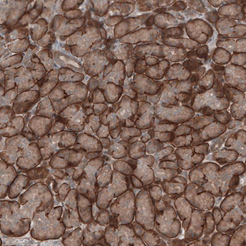 Immunohistochemistry (Formalin/PFA-fixed paraffin-embedded sections) - Anti-KANK4 antibody (AB121410), expandable thumbnail