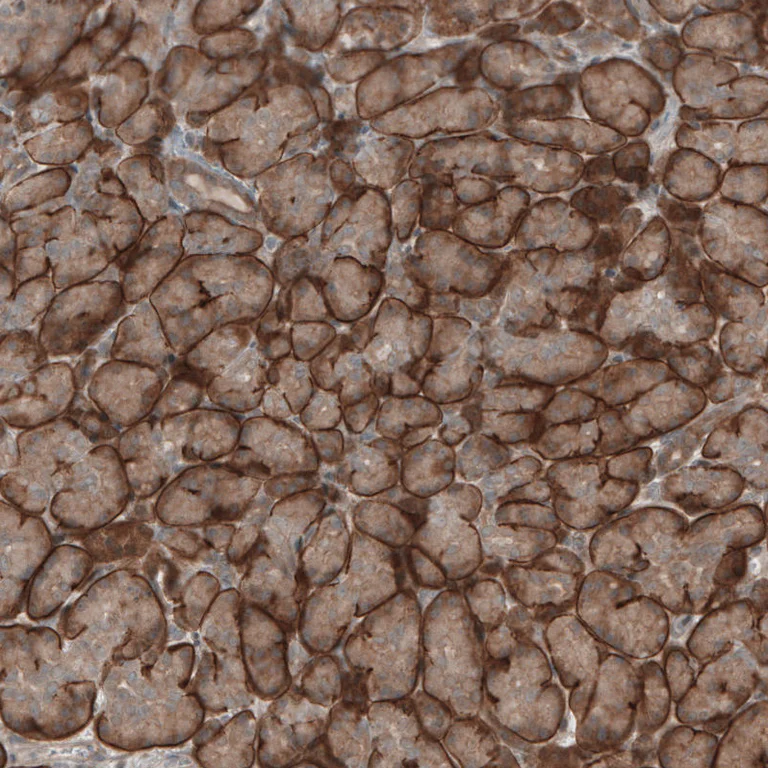 Immunohistochemistry (Formalin/PFA-fixed paraffin-embedded sections) - Anti-KANK4 antibody (AB121410)