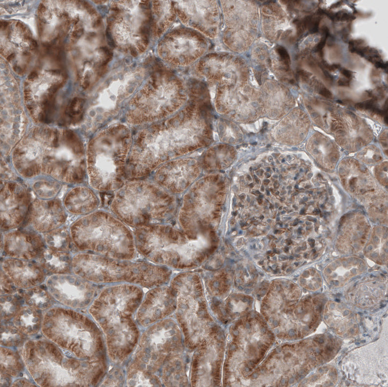 Immunohistochemistry (Formalin/PFA-fixed paraffin-embedded sections) - Anti-KANK4 antibody (AB121410), expandable thumbnail