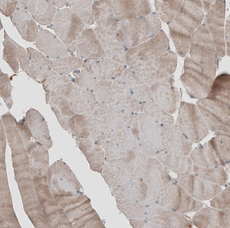 Immunohistochemistry (Formalin/PFA-fixed paraffin-embedded sections) - Anti-KANK4 antibody (AB121410)