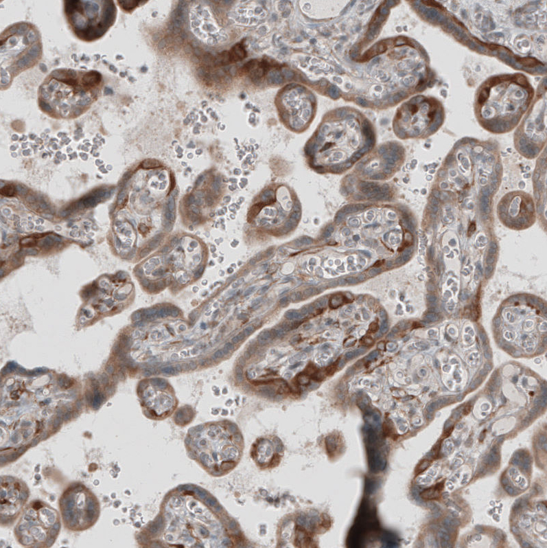 Immunohistochemistry (Formalin/PFA-fixed paraffin-embedded sections) - Anti-KANK4 antibody (AB121410), expandable thumbnail