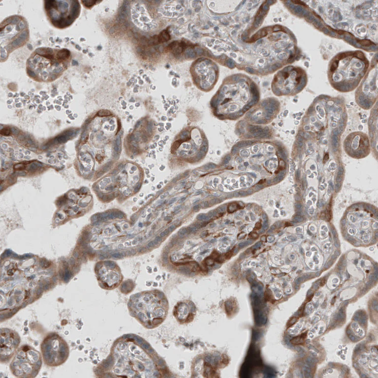 Immunohistochemistry (Formalin/PFA-fixed paraffin-embedded sections) - Anti-KANK4 antibody (AB121410)