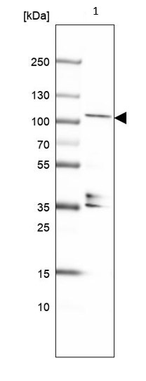 Western blot - Anti-KANK4 antibody (AB121410), expandable thumbnail