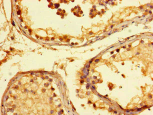 Immunohistochemistry (Formalin/PFA-fixed paraffin-embedded sections) - Anti-KANSL1 antibody (AB230008)