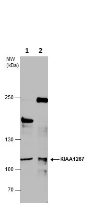 Western blot - Anti-KANSL1 antibody - N-terminal (AB228899)