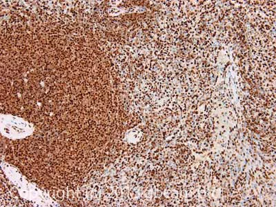Immunohistochemistry (Formalin/PFA-fixed paraffin-embedded sections) - Anti-KAP1 antibody [20C1] (AB22553)