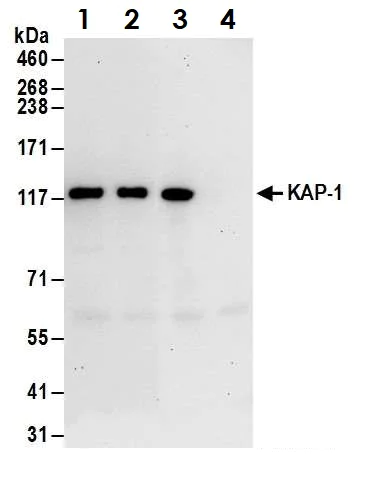 Immunoprecipitation - Anti-KAP1 antibody (AB10483)