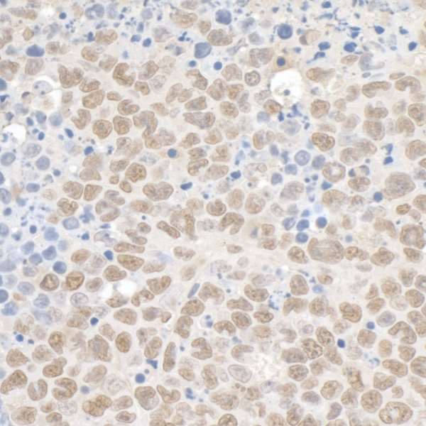 Immunohistochemistry (Formalin/PFA-fixed paraffin-embedded sections) - Anti-KAP1 antibody (AB10484), expandable thumbnail
