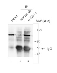 Immunoprecipitation - Anti-KAP1 antibody (AB190178), expandable thumbnail