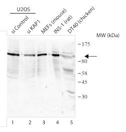 Western blot - Anti-KAP1 antibody (AB190178), expandable thumbnail