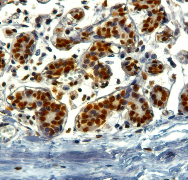 Immunohistochemistry (Formalin/PFA-fixed paraffin-embedded sections) - Anti-KAP1 antibody (AB3831)