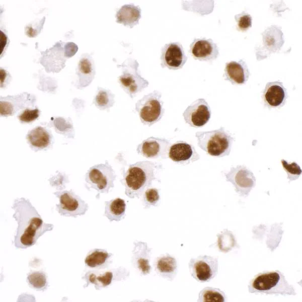 Immunocytochemistry - Anti-KAP1 antibody [BL-248-2G6] (AB243871)