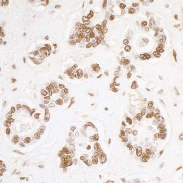 Immunohistochemistry (Formalin/PFA-fixed paraffin-embedded sections) - Anti-KAP1 antibody [BL-248-2G6] (AB243871)