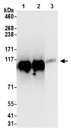 Immunoprecipitation - Anti-KAP1 antibody [BL-248-2G6] (AB243871)