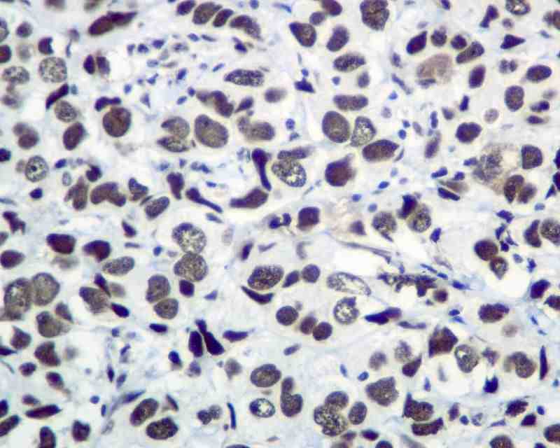 Immunohistochemistry (Formalin/PFA-fixed paraffin-embedded sections) - Anti-KAP1 antibody [EPR5216] (AB109287), expandable thumbnail
