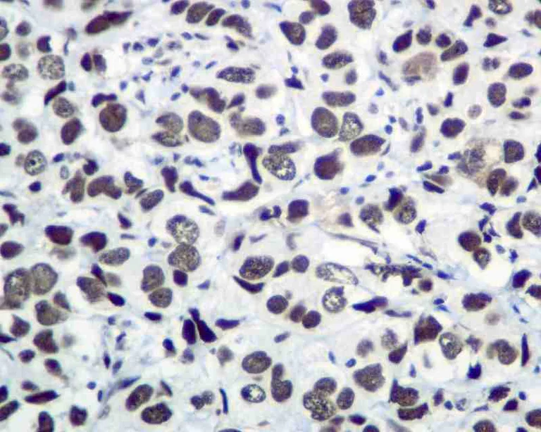 Immunohistochemistry (Formalin/PFA-fixed paraffin-embedded sections) - Anti-KAP1 antibody [EPR5216] (AB109287)