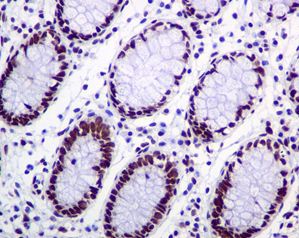 Immunohistochemistry (Formalin/PFA-fixed paraffin-embedded sections) - Anti-KAP1 antibody [EPR5216] (AB109287), expandable thumbnail