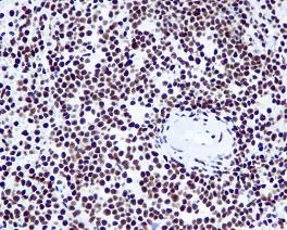 Immunohistochemistry (Formalin/PFA-fixed paraffin-embedded sections) - Anti-KAP1 antibody [EPR5217] - BSA and Azide free (AB215550)