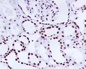 Immunohistochemistry (Formalin/PFA-fixed paraffin-embedded sections) - Anti-KAP1 antibody [EPR5249] (AB109545)