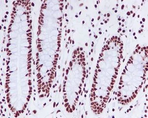 Immunohistochemistry (Formalin/PFA-fixed paraffin-embedded sections) - Anti-KAP1 antibody [EPR5249] (AB109545)