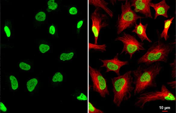Immunocytochemistry/ Immunofluorescence - Anti-KAP1 antibody [HL1539] (AB308164)