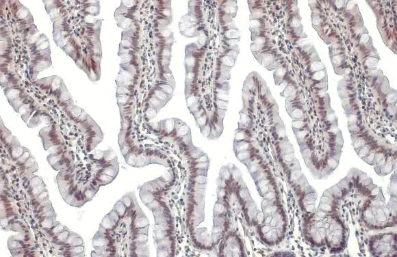 Immunohistochemistry (Formalin/PFA-fixed paraffin-embedded sections) - Anti-KAP1 antibody [HL1539] (AB308164)