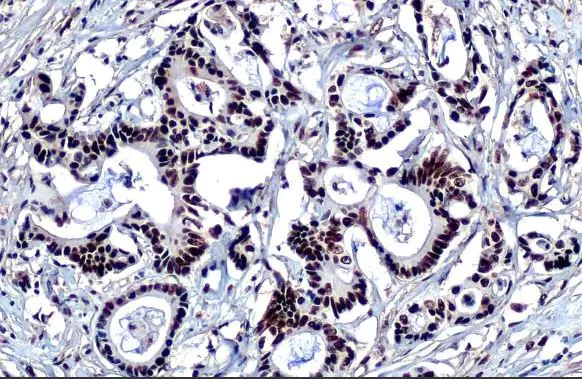 Immunohistochemistry (Formalin/PFA-fixed paraffin-embedded sections) - Anti-KAP1 antibody [HL1539] (AB308164)