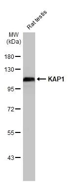 Western blot - Anti-KAP1 antibody [HL1539] (AB308164)