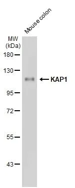 Western blot - Anti-KAP1 antibody [HL1539] (AB308164)