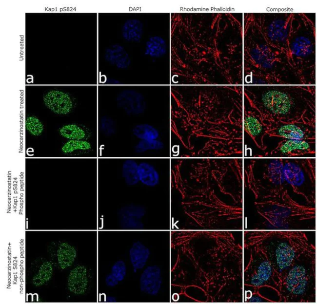 Immunocytochemistry/ Immunofluorescence - Anti-KAP1 (phosho S824) Antibody [RP23040148] (AB313457)