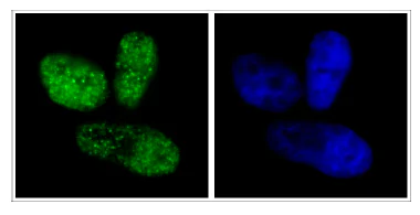 Immunocytochemistry/ Immunofluorescence - Anti-KAP1 (phospho S824) antibody (AB84077)