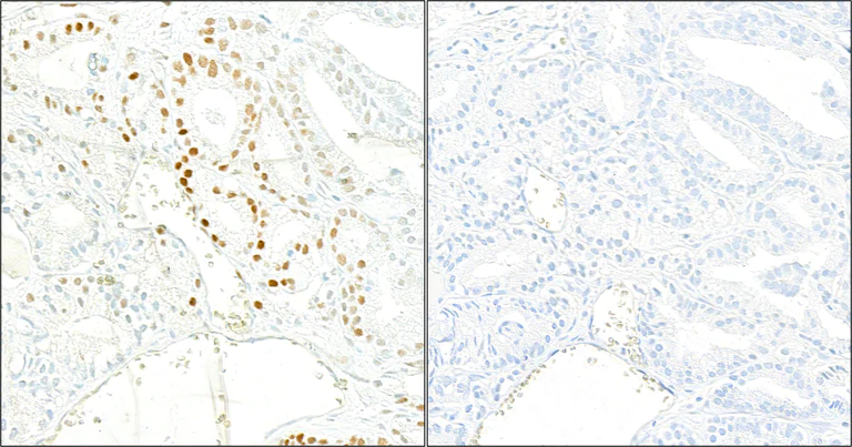 Immunohistochemistry (Formalin/PFA-fixed paraffin-embedded sections) - Anti-KAP1 (phospho S824) antibody [BL-246-7B5] (AB243870)