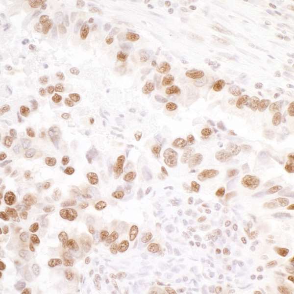 Immunohistochemistry (Formalin/PFA-fixed paraffin-embedded sections) - Anti-KAP1 (phospho S824) antibody [BL-246-7B5] - BSA free (AB272068), expandable thumbnail