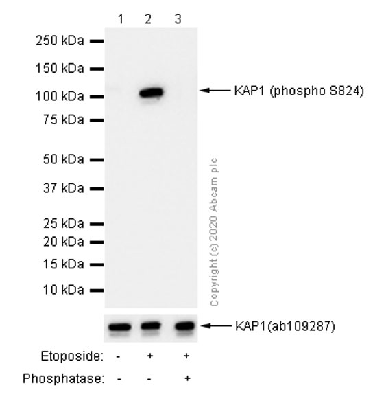 Western blot - Anti-KAP1 (phospho S824) antibody [EPR5248] (AB133440), expandable thumbnail