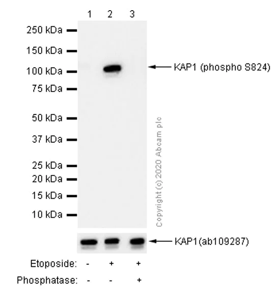 Western blot - Anti-KAP1 (phospho S824) antibody [EPR5248] - BSA and Azide free (AB215549)
