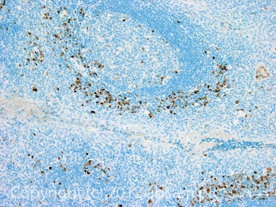 Immunohistochemistry (Formalin/PFA-fixed paraffin-embedded sections) - Anti-Kappa light chain antibody [4G7] (AB1936), expandable thumbnail