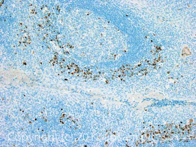 Immunohistochemistry (Formalin/PFA-fixed paraffin-embedded sections) - Anti-Kappa light chain antibody [4G7] (AB1936)