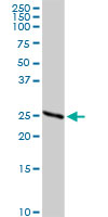Western blot - Anti-Kappa light chain antibody (AB103827)