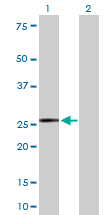 Western blot - Anti-Kappa light chain antibody (AB103827)