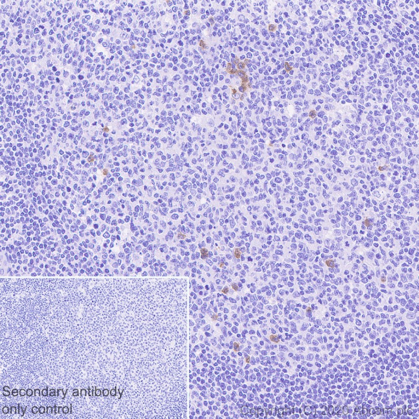 Immunohistochemistry (Formalin/PFA-fixed paraffin-embedded sections) - Anti-Kappa light chain antibody [EPR5367-8] (AB124727)
