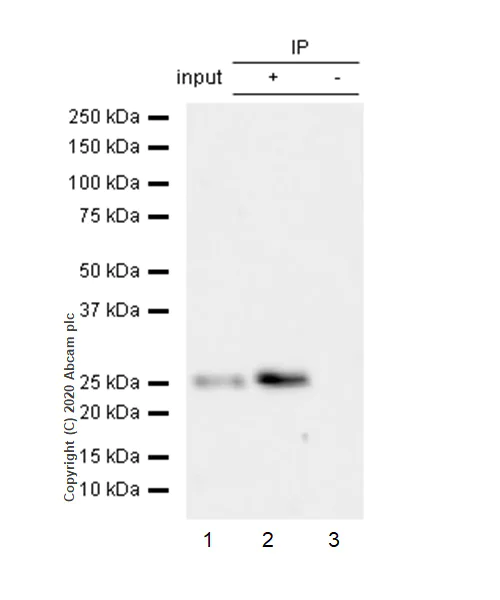 Immunoprecipitation - Anti-Kappa light chain antibody [EPR5367-8] (AB124727)