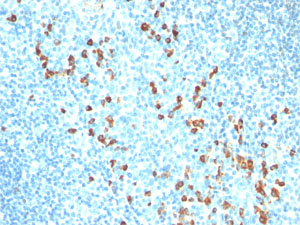 Immunohistochemistry (Formalin/PFA-fixed paraffin-embedded sections) - Anti-Kappa light chain antibody [HP6053-L1C1] (AB200546), expandable thumbnail