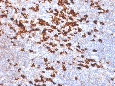 Immunohistochemistry (Formalin/PFA-fixed paraffin-embedded sections) - Anti-Kappa light chain antibody [IGKC/1999R] - BSA and Azide free (AB237853)