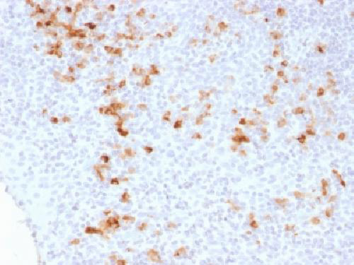 Immunohistochemistry (Formalin/PFA-fixed paraffin-embedded sections) - Anti-Kappa light chain antibody [KLC1278] (AB218429)