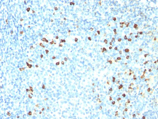 Immunohistochemistry (Formalin/PFA-fixed paraffin-embedded sections) - Anti-Kappa light chain antibody [KLC264] (AB190760), expandable thumbnail