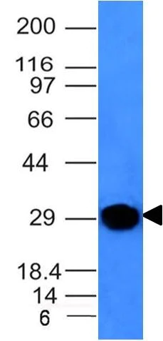 Western blot - Anti-Kappa light chain antibody [KLC264] (AB190760)
